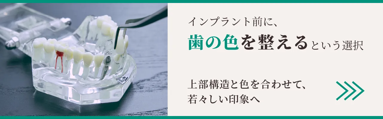 インプラント前に、歯の色を整えるという選択