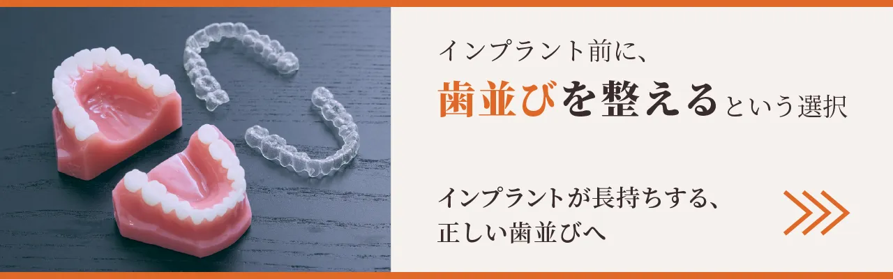 インプラント前に、歯並びを整えるという選択