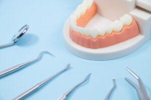 インプラントオールオン4を検討中の方必見！失敗しない選び方と適応条件