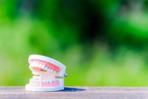 インプラントでのヒーリングキャップ装着後の痛みや違和感は正常？再診の目安と対処法