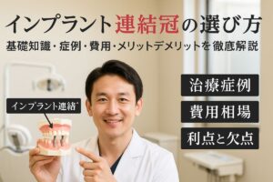 インプラント連結冠の基礎知識と選び方ガイド｜症例や費用、メリットデメリットを徹底解説