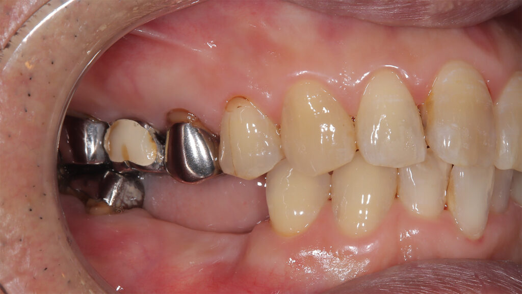 Before