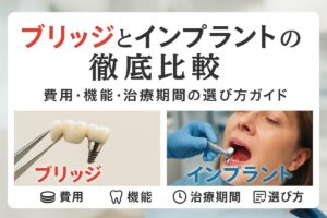 ブリッジとインプラントの違いを徹底比較｜費用・機能・治療期間の選び方ガイド