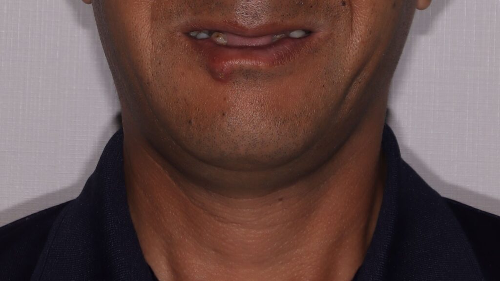After