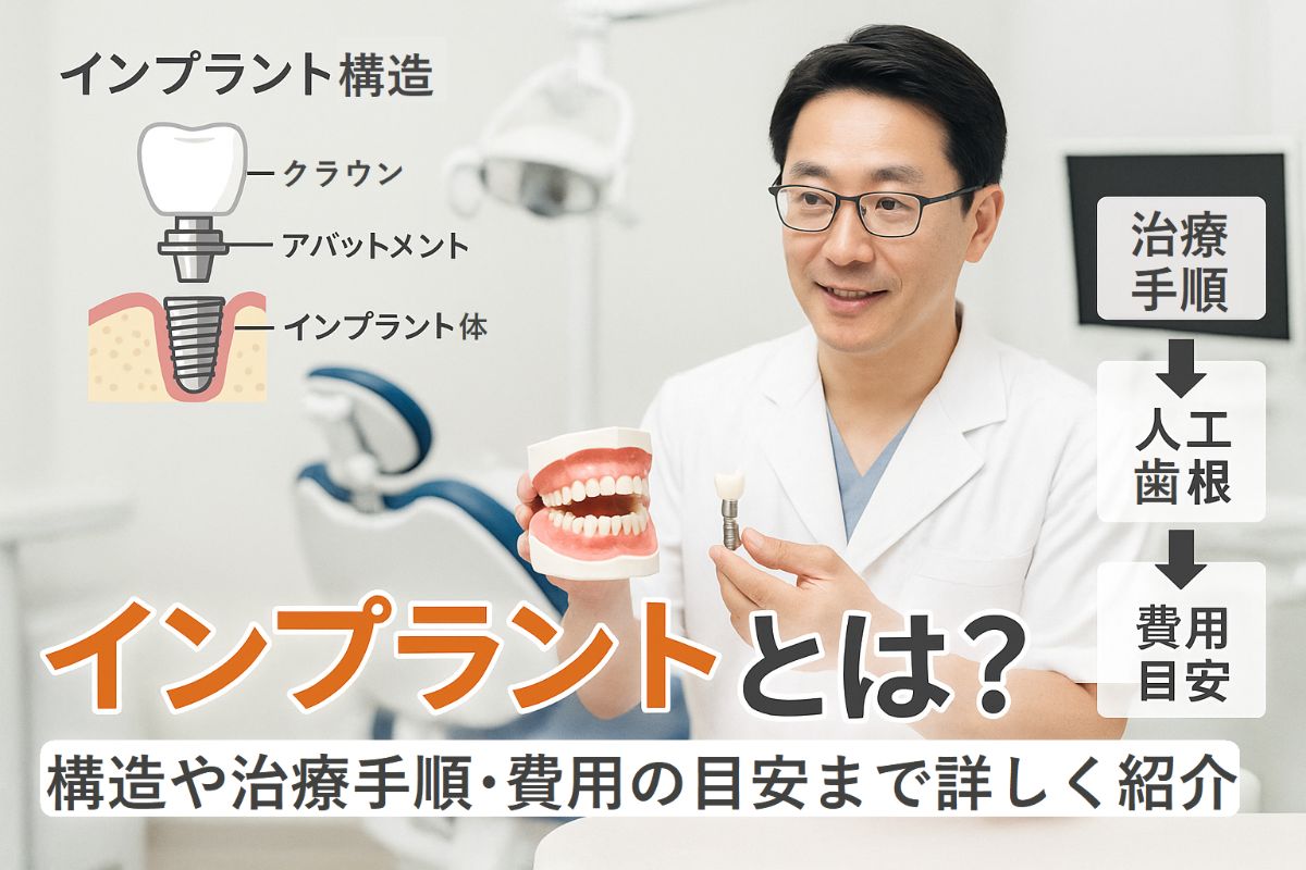 インプラントとは？仕組みや構造・治療の流れ・費用相場など徹底解説 | T DENTAL OFFICE 大阪天王寺インプラントクリニック