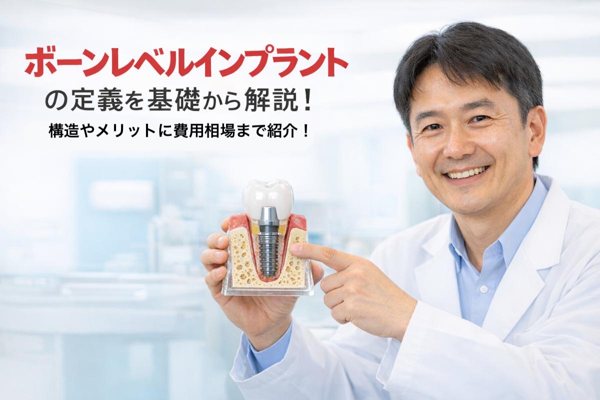 ボーンレベルインプラントの定義を基礎から解説｜構造やメリットに費用