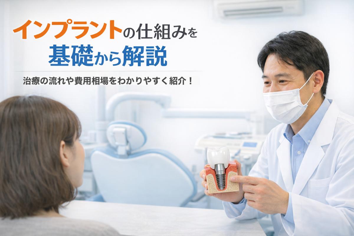 インプラントの仕組みを基礎から解説｜治療の流れや費用相場をわかり