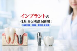 インプラントの仕組みと構造を解説｜治療手順・種類・費用の全知識