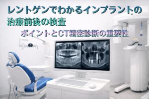 レントゲンでわかるインプラントの治療前後の検査ポイントとCT精密診断の重要性