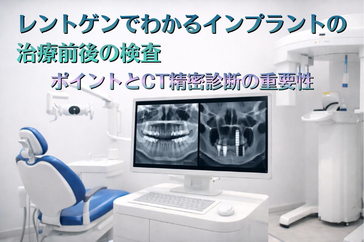 レントゲンでわかるインプラントの治療前後の検査ポイントとCT精密診断