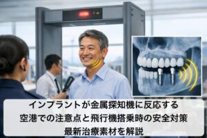 インプラントが金属探知機に反応する空港での注意点と飛行機搭乗時の安全対策・最新治療素材を解説