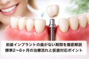 前歯インプラントの歯がない期間を徹底解説｜標準2〜6ヶ月の治療流れと仮歯対応ポイント