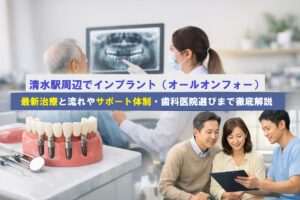 清水駅周辺でインプラント（オールオンフォー）最新治療と流れやサポート体制・歯科医院選びまで徹底解説