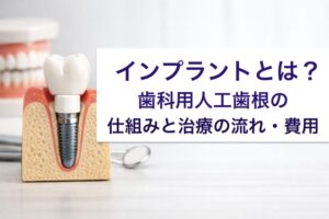 インプラントとは？歯科用人工歯根の仕組みと治療の流れ・費用