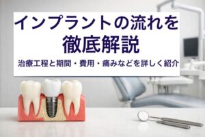 インプラントの流れを徹底解説｜治療工程と期間・費用・痛みなどを詳しく紹介