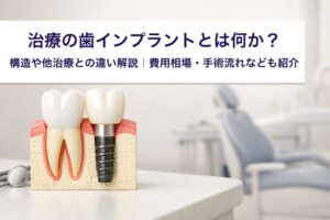 治療の歯インプラントとは何か？構造や他治療との違い解説｜費用相場・手術流れなども紹介