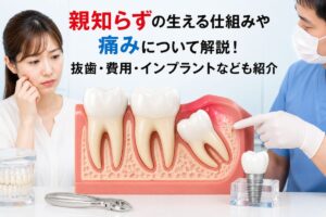 親知らずの生える仕組みや痛みについて解説！抜歯・費用・インプラントなども紹介