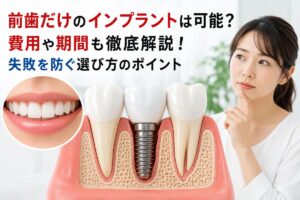 前歯だけのインプラントは可能？費用や期間も徹底解説！失敗を防ぐ選び方のポイント