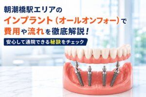 朝潮橋駅エリアのインプラント（オールオンフォー）で費用や流れを徹底解説！安心して通院できる秘訣をチェック