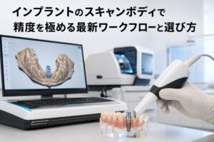 インプラントのスキャンボディで精度を極める最新ワークフローと選び方