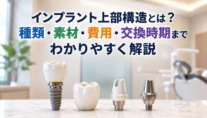 インプラント上部構造とは？種類・素材・費用・交換時期までわかりやすく解説