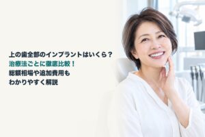 上の歯全部のインプラントはいくら？治療法ごとに徹底比較！総額相場や追加費用もわかりやすく解説