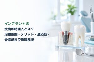 インプラントの抜歯即時埋入とは？治療期間・メリット・適応症・骨造成まで徹底解説